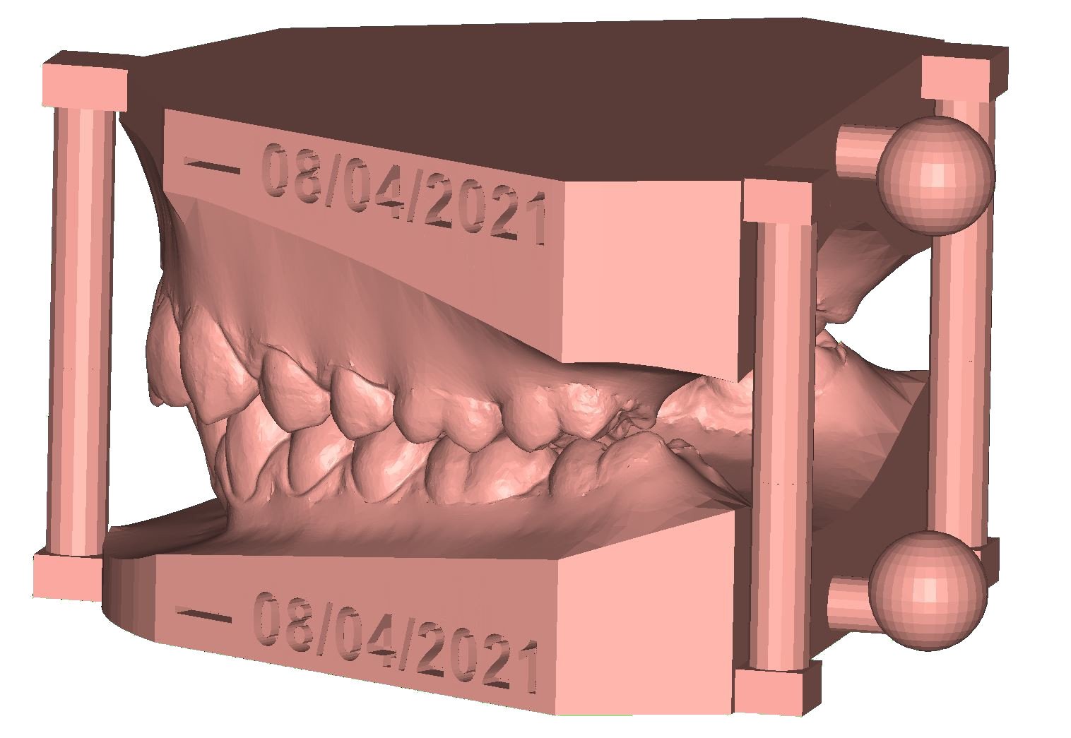 Artikülatör fiksatörlü, tarih kazımalı 3D dental model