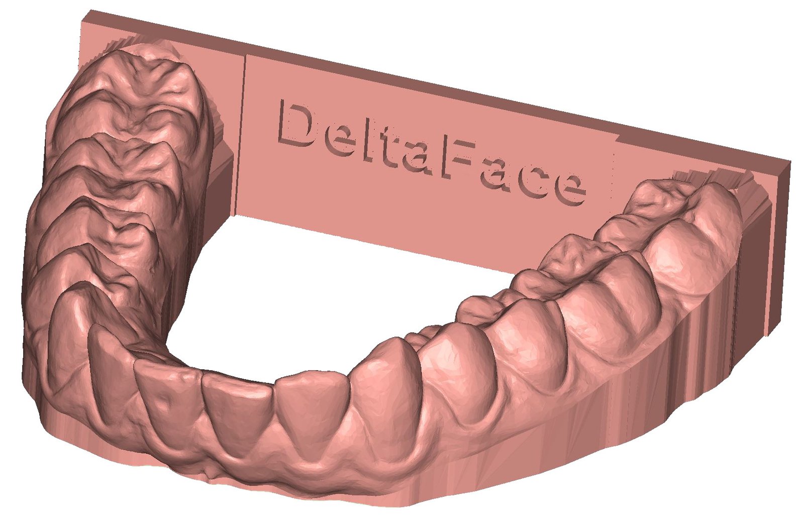 Arch Base ile kaidelendirilmiş dental model