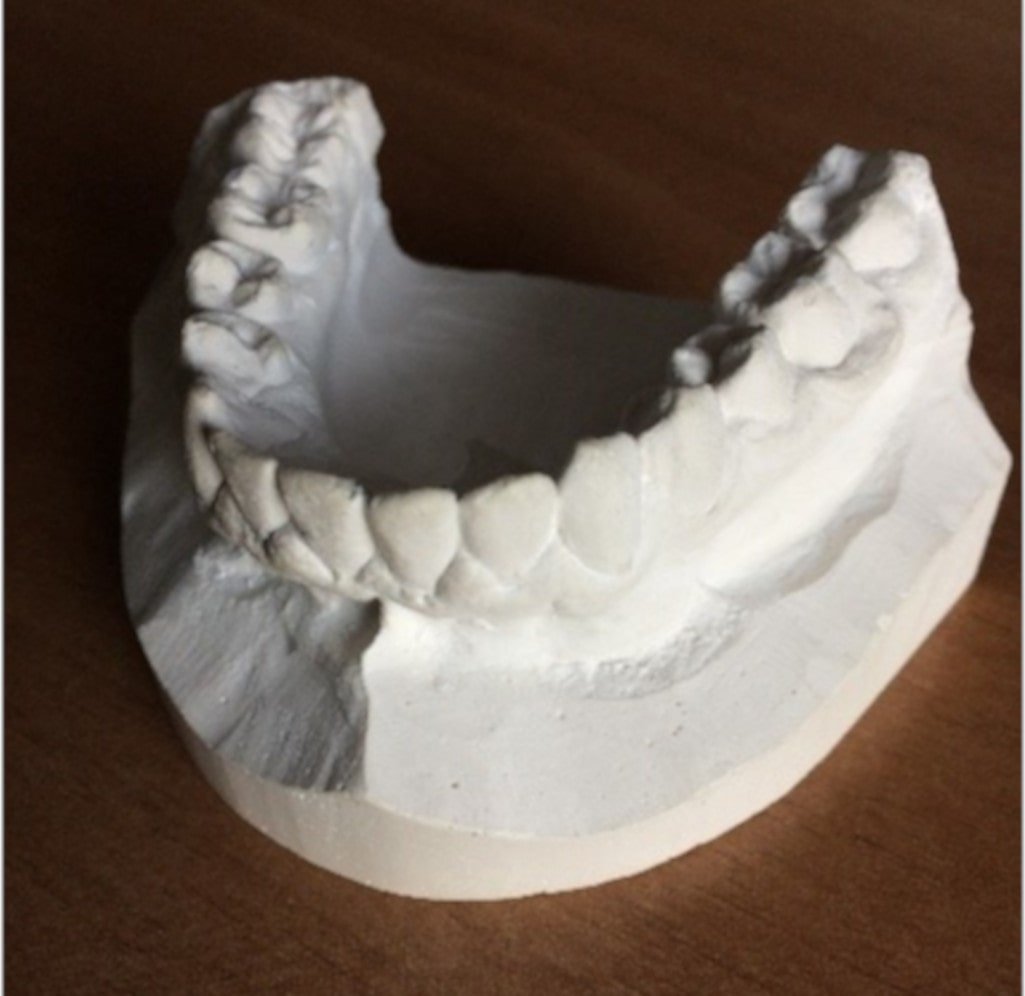 Alçı dental model